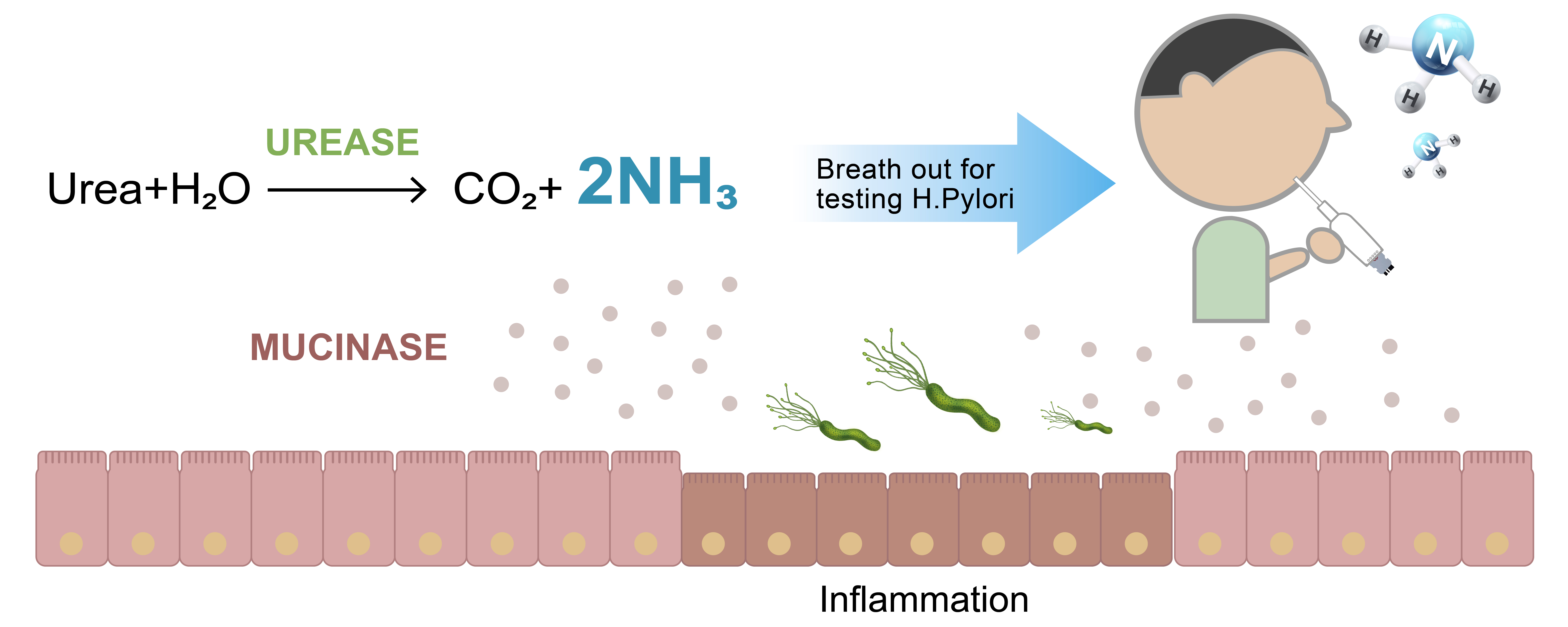 Comparison of UltraPeace detection principle and C13/14 H. pylori urea breath test principle - UltraE